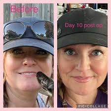 Hello! I wanted to ask you if any of you have had lower back pain, a  herniated disc or something similar and if this could be the cause of  BII?😓😪 and when