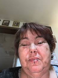 Dennis Alan White Obituary March 2, 2025