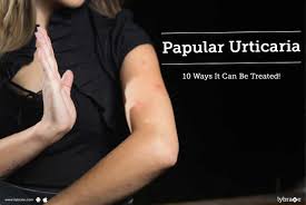 Image result for Papular urticaria