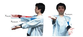 Image result for Cerebellar Function Test