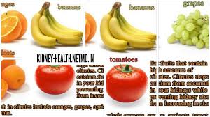 Healthy Diet Plan Can Save Kidney Patients Tips To Manage Kidney Stones Healthy Diet Plans Healthy Diet Healthy