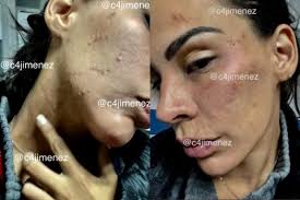 Самые новые твиты от steph gómez (@stephngomez): Eleazar Gomez Fotos De Stephanie Valenzuela Tras Ser Estrangulada Y Golpeada Por El Actor En Mexico Televisa Cdmx Tvmas El Comercio Peru