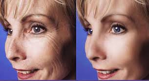 Mu oju pada ni Photoshop