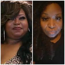 4 months after my surgery 100 pounds less