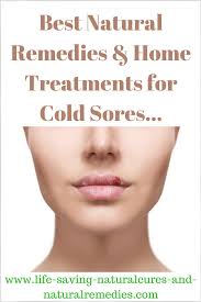 How To Get Rid Of A Lip Cold Sore Fast Best Home Remedies Natural Treatments For Mouth Fever Blisters Insta Cold Sore Fever Blister Fever Blister Remedy