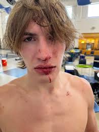 Exeter Wrestling Team Performs Well at Pins in the Park Tournament