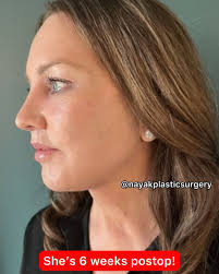 Perde 50 quilos, faz um lifting e ninguém acreditou que fosse a mesma. Veja  o antes e depois