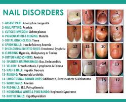 Image Result For Types Of Fingernails Nclex Nail Disorders
