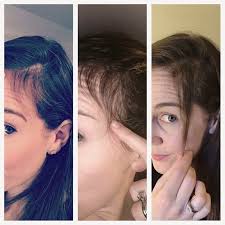 Check out this blog post!🙌🏻 A great breakdown of why natural products are  optimal in hair growth🌿 Also a great description about Monat products, I  just couldn't stop smiling while reading❣ |