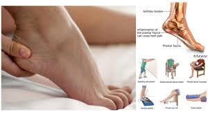 .ubat sakit pinggul, ubat sakit telinga, ubat sakit pinggang, ubat sakit urat saraf, ubat sakit tumit kaki, ubat sakit lutut traditional, ubat sakit badan, ubat sakit kulit cara islam, ubat sakit pergelangan. Sakit Tumit Bila Bangun Pagi 7 Perkara Tentang Plantar Fasciitis Kena Tahu