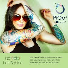 Presenting a guide on tattoo removal, including diy tattoo removal at home (which we don't speaking of different methods, did you know that some people remove their tattoos at home, or at. Piqo4 Laser Tattoo Removal Lewisburg Plastic Surgery And Dermatology