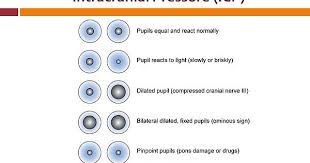Pupil Dilation Chart Album On Imgur