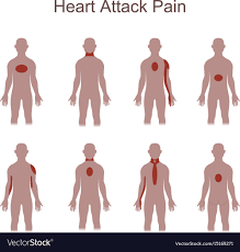Heart Attack Pain Location Royalty Free Vector Image