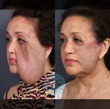 Dora Caro @bellezacolombianaspaplano stands as a beacon of excellence in  the realm of personal care and wellness. With a steadfast commitment to  providing unparalleled service, Dora Caro Spa delivers transformative  experiences that