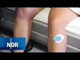 Restless Legs Syndrom Symptome Und Behandlung Visite Ndr Youtube Gesundheitstipps Behandlung Gesundheit