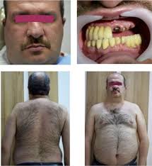 Clinical Case Reports: Vol 9, No 10