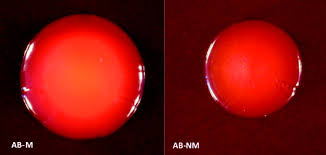 Congo red agar (cra) screening is not useful as a qualitative screening method for biofilm formation.the combination of cra and microplate and clsm methods provided a better prediction of. Cell Surface Properties Of Two Differently Virulent Strains Of Acinetobacter Baumannii Isolated From A Patient