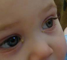 Atencion A Los Ojos Del Bebe