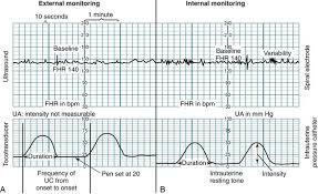 Fetal Assessment During Labor Nurse Key