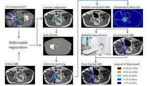 English and spanish anatomical chart desktop collection. Flow Chart Of Online Mr Linac Workflow Anatomical Contours Yellow Download Scientific Diagram