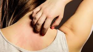 Juckreiz Ursachen Diagnose Therapie Onmeda De