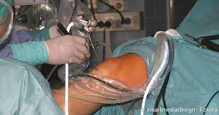 Bacterial contamination of redon drainage systems was seen in 25% of the aseptic procedures that were. Kniespiegelung Methode Grunde Ablauf Netdoktor