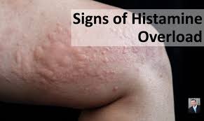 Image result for Histamine