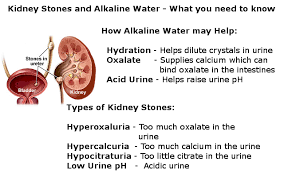 What You Need To Know About Alkaline Water And Kidney Stones Kidney Stones Home Treatment Kidney