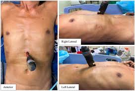 Trauma Surgery & Acute Care Open