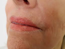 We went to to pfrankmd & skin salon get a tattoo, but not on our body, on our lips! Permanent Lip Color Tattoo Near Me Archives Goddess Permanent Makeup