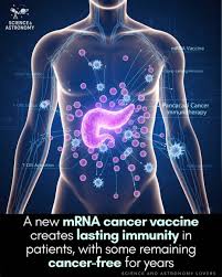 🚨 Medical Breakthrough Alert! Scientists have developed a groundbreaking  mRNA vaccine for pancreatic cancer — one of the deadliest cancers in the  world. In a recent clinical trial, this personalized vaccine trained