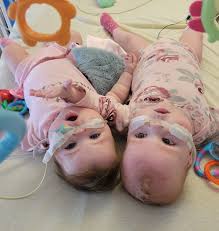 What baby items can be donated to a young mother in need?