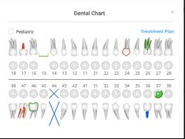 Detailed Dental Charting For Dentists Clinicia Mumbai