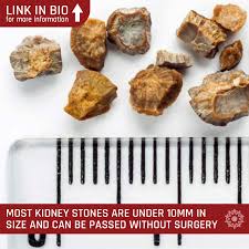 We assume the stone is small enough to be passable. 4 Keys To Naturally Passing Kidney Stones Kidney Stones Passing Kidney Stones Kidney