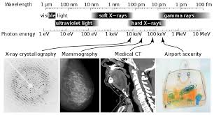 X Ray Wikipedia