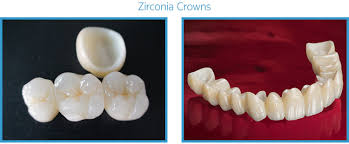 Cheapest priced dental implants near you. Prosthodontics Guru Krupa