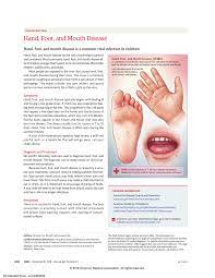 Hand, foot and mouth disease is a mild viral illness that can occur at any age, but occurs most often in children younger than ten. Pdf Hand Foot And Mouth Disease