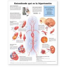 Understanding Hypertension Anatomical Chart In Spanish Entendiendo Que Es La Hypertension