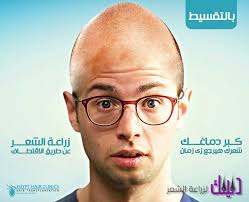 مركز Egypt Hair لزراعة الشعر في مصر دليلك لزراعة الشعر