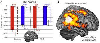 B ¼ background, a ¼ action, o ¼ outcome, i ¼ intent, j ¼ judgment. Http Docs Autismresearchcentre Com Papers 2011 Lombardo Spec Neuroimage Pdf