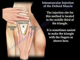 Deltoid Intramuscular Injection Everything You Need To Know Dr Nabil Ebraheim Youtube Pharmacology Nursing Medical Assistant Student Medical Knowledge
