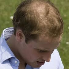 Laser therapy irradiates photons into scalp tissues to stimulate hair growth and is the least invasive of the three treatments. Best Natural Hair Loss Remedies Home Facebook