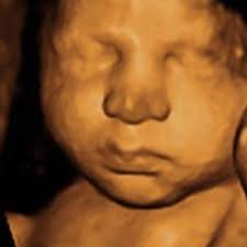 A Precious Glimpse Baby Ultrasound Studio