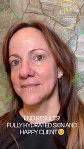 This is your sign to give your skin the glow that it deserves ✨ One facial.  Total reset. Radiance unlocked 💆‍♀️💖, #deepcleansingfacial #deepcleaning  #epicbeautywellnesshomestead #facialhomestead ...