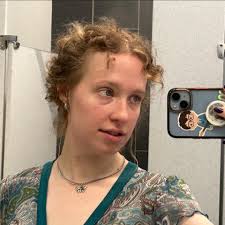 What do you see in this photomicrograph?