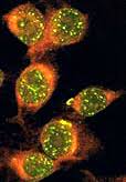 Image result for ANA Staining Pattern