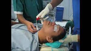 Intubation porn