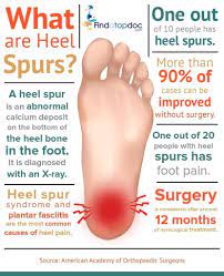 Heel Spurs: What Are The Symptoms, Causes, And Treatments?