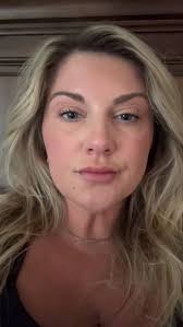 Just Wait for It 💉, Before. Settling. Snatched., •, Not instant. Not  overdone., Just a gradual fade to flawless., •, Snag your TOX appointment  today and be ready for those Holiday selfies! 🎄📸, •, ➡️ ...