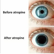 Image result for Mydriasis
